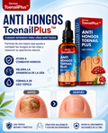 Aceite Antihongos para Uñas ToenailPlus 10 ml – Uso Tópico con Gotero